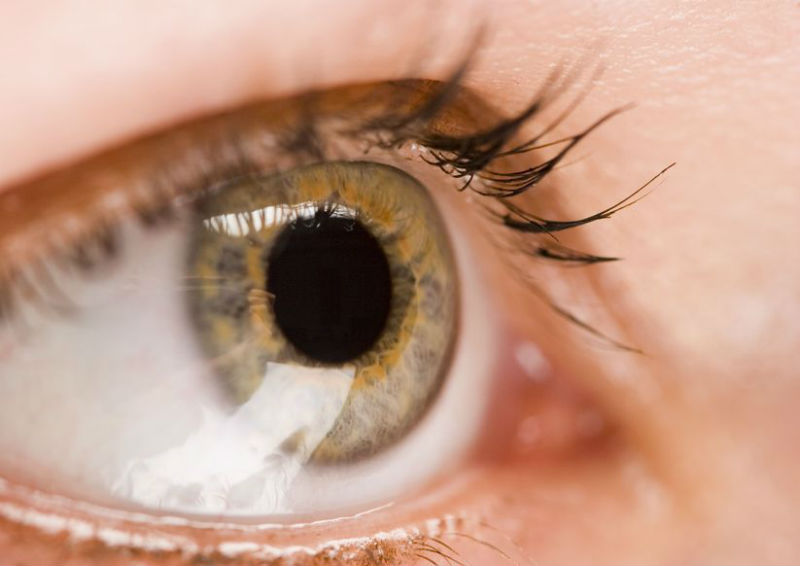 What Can A Patient Expect From Eye Surgery Done in Wichita, KS?