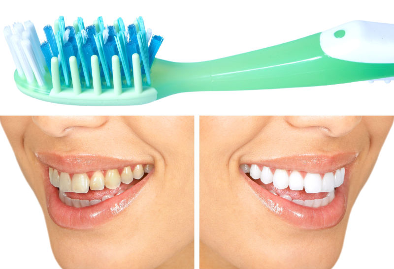 Signs That Indicate You Need Orthodontic Treatment in Vancouver, WA