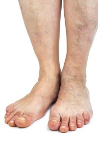 The Importance of Foot Health: Podiatrist in Portland, OR