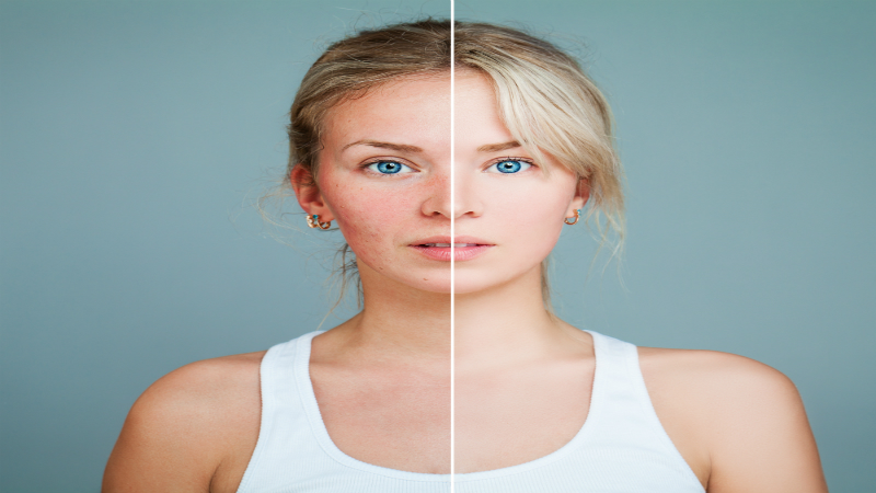What You Should Know If You’re Considering a Nose Job in Lisle, IL