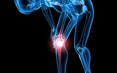 How a Knee Doctor Diagnoses Knee Problems and Injuries in New Haven, CT