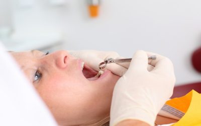You Can Get a Bright and Beautiful Smile in Wilton Manors, FL