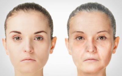 Feel Better About Your Face! – Skin Tightening Treatments in Marietta, GA